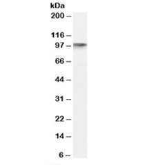 Western blot testing of human hippocampus lysate with DISC1 antibody at 0.1ug/ml. Predicted molecula