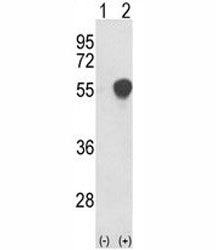 PHGDH Antibody