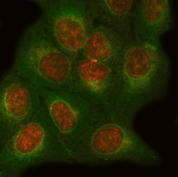 Immunofluorescent staining of FFPE human U-2 OS cells with ONECUT1 antibody (red) and Beta Tubulin m