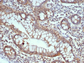 S100G Antibody / Calbindin D9K