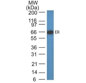 Western blot testing of human MCF7 cell lysate with Estrogen Receptor antibody (ER505). Predicted mo