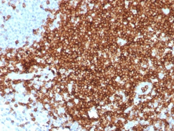 IHC staining of FFPE human tonsil tissue with recombinant CD7 antibody (clone CD7/8496R). HIER: boil
