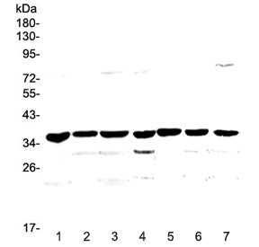 uPAR Antibody / uPA Receptor
