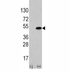 Western blot analysis of ATF4 antibody and 293 cell lysate (2 ug/lane) either nontransfected (Lane 1