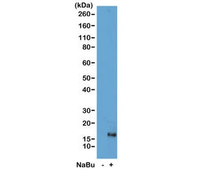 H3K79ac Antibody / Acetyl Histone H3 Lysine 79