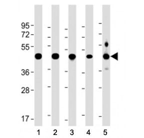 NSFL1C Antibody (Center Region)