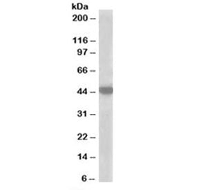 Western blot testing of A549 lysate with MCT2 antibody at 1ug/ml. Predicted molecular weight: ~52 kD