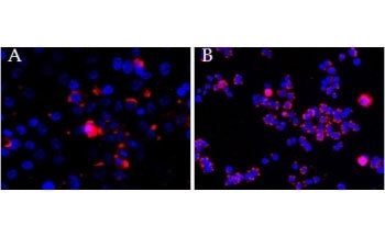 CEP290 antibody (2.5ug/ml) overnight staining of cell lines OPCT-1 [A] and MDA468 [B] with Alexa Flu