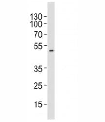 Western blot analysis of lysate from HT-29 cell line using AURKA antibody at 1:1000. Predicted molec