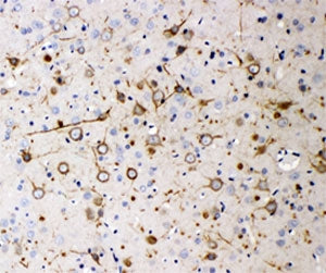 Neurofilament 200 Antibody (Heavy)