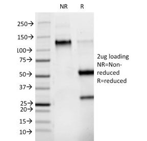 SDS-PAGE analysis of purified, BSA-free Phosphotyrosine antibody (clone PY265) as confirmation of in