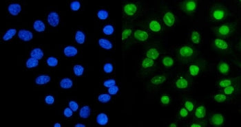 Immunofluorescent staining of FFPE human A549 cells with Ku70 antibody (green) and DAPI nuclear stai