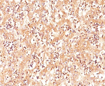 IHC testing of human fetal liver stained with AFP antibody (C3).