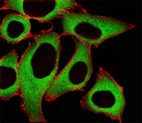 ALDH1A1 Antibody