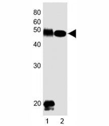 Western blot testing of DLK1 antibody at 1:1000 dilution. Lane 1: human placenta lysate; 2: mouse sk