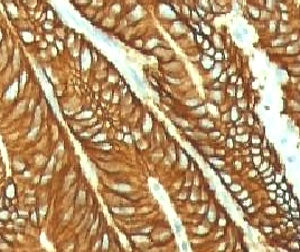EpCAM Antibody