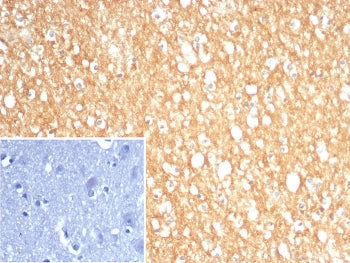 S100A5 Antibody