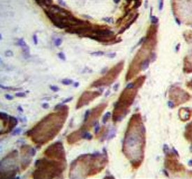 Filamin A Antibody / FLNA