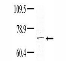 TNK1 Antibody