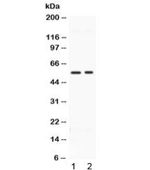 BMP15 Antibody / Bone morphogenetic protein 15