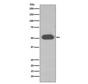 VDBP Antibody / Vitamin D binding protein
