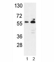 G6PD Antibody
