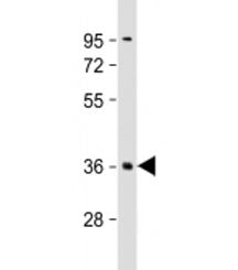Western blot testing of human brain lysate with PLK5 antibody at 1:2000. Predicted molecular weight: