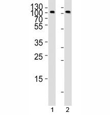 Western blot analysis of lysate from 1) Raji and 2) Ramos cell line using anti-CD19 antibody at 1:10