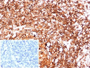 HLA-DR Antibody (MHC II)