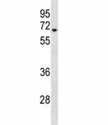 HAS3 Antibody