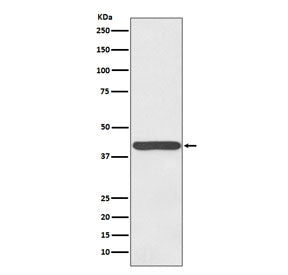 Haptoglobin Antibody