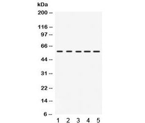 Western blot testing of 1) rat intestine, 2) human HeLa, 3) human COLO320, 4) mouse NIH3T3 and 5) mo