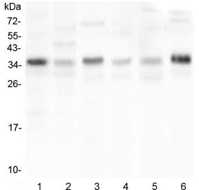 CD40L Antibody / TRAP / CD154