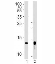 Western blot analysis of lysate from human placenta tissue lysate, SK-BR-3 cell line (left to right)