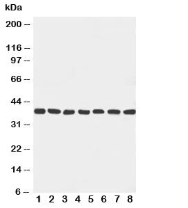 Western blot testing with Mek6 antibody and rat samples: 1. ovary; 2. spleen; 3. brain; 4. heart; 5.