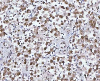 SF3A2 Antibody / Splicing factor 3A subunit 2 / SF3a66