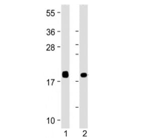 VILIP1 Antibody / Visinin-like protein 1 / VSNL1