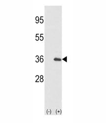 IL-1 alpha Antibody