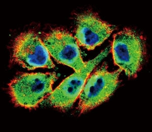 Confocal immunofluorescent analysis of EphB2 antibody with A375 cells followed by Alexa Fluor 488-co