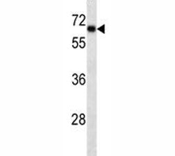 SOX9 antibody western blot analysis in HepG2 lysate. Predicted molecular weight: 56-65 kDa.