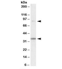 LDB3 Antibody