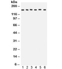 ROCK2 Antibody