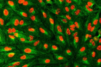 Immunofluorescent staining of FFPE human A549 cells with SART1 antibody (red) and Beta Tubulin mAb (