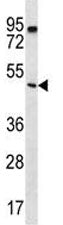 PTEN Antibody