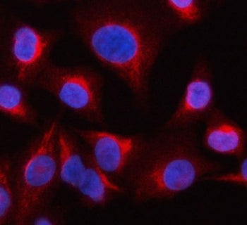 OCRL-1 Antibody
