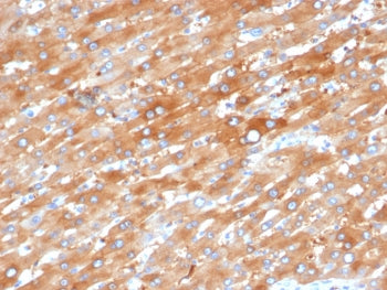 IHC staining of FFPE human liver in colon with EPHB4 antibody (clone EPHB4/6392). HIER: boil tissue 