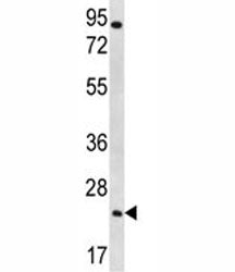 AQP5 Antibody