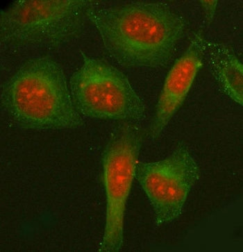 NCOA5 Antibody / Nuclear receptor coactivator 5