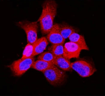 Immunofluorescent staining of FFPE human A431 cells with ARF6 antibody (red) and DAPI nuclear stain 