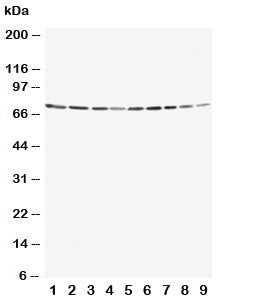 Western blot testing of Annexin VI antibody and Lane 1: rat ovary; 2: rat liver; 3: rat intestinum t